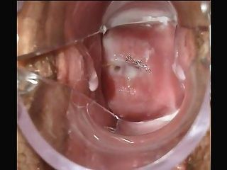 Speculum Cum