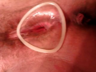 Female Condom