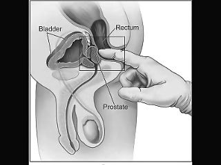 How To Milk Your Prostate By Yourself